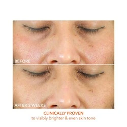 Dr Dennis Gross Vitamin C + Lactic Oil-Free Radiant Moisturizer 5 Dr Dennis Gross Vitamin C + Lactic Oil-Free Radiant Moisturizer - Image 3